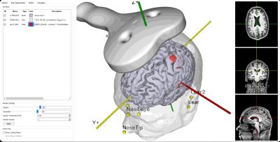 Repetitive Transcranial Magnetic Stimulation Specialist Jacksonville NC
